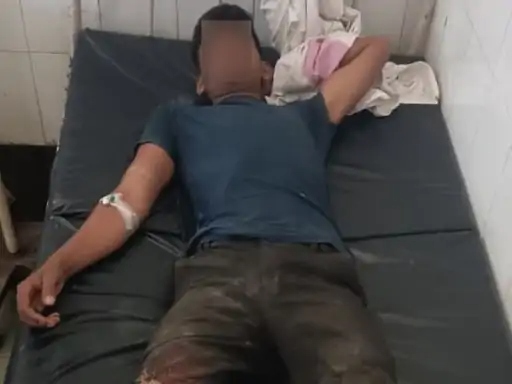 फिरोजाबाद में 25 हजार काइनामी बदमाश गिरफ्तार:पैर में लगी गोली, पुलिसकर्मियों को कुचलने का प्रयास करने वाला पकड़ा गया, सीसीटीवी आया था सामने